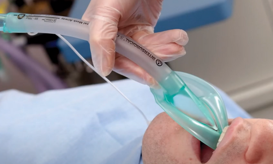 Intersurgical laryngeal mask range