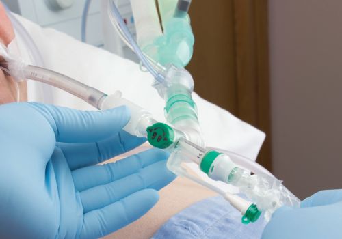 our-initiatives-infection-control-image-TrachSeal