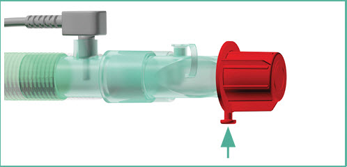 tube mgt