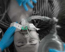 i-gel resus