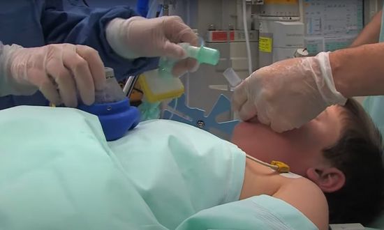 Use of the i-gel® supraglottic airway in pediatric surgery 