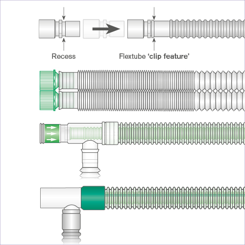 anaesthetic-breathing-circuits-breathing-systems-image